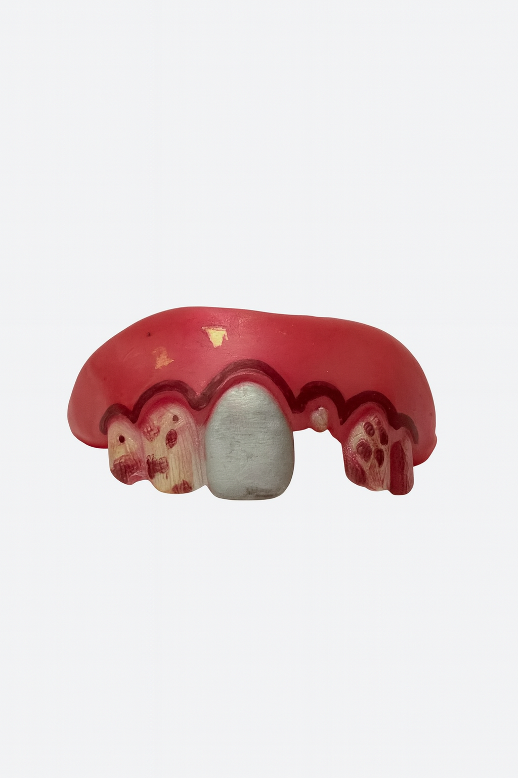 DIENTES CAREADOS Y DEFORMES